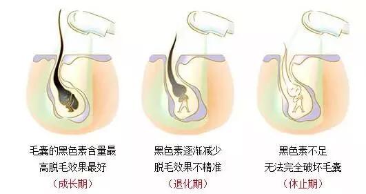 冰点激光脱毛的原理_冰点激光脱毛原理:   冰点激光脱毛,是利用冰点激光深入毛囊组织,激光可